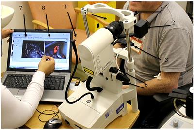 Corneal Confocal Microscopy to Image Small Nerve Fiber Degeneration: Ophthalmology Meets Neurology